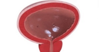 bladder stone doctor lahore